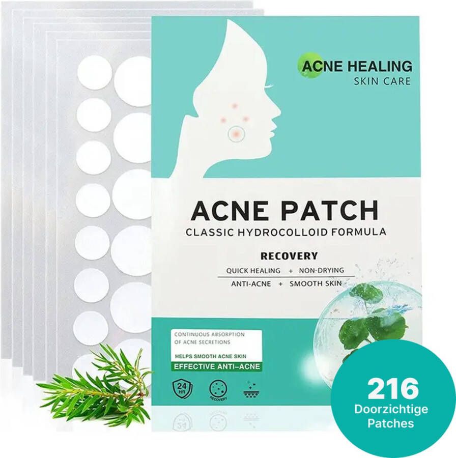 ACNE HEALING Pimple Patches Puisten Pleister Acne Pleister Puisten verwijderaar Acne Sticker Pimple patch pimple patches 216 stuks