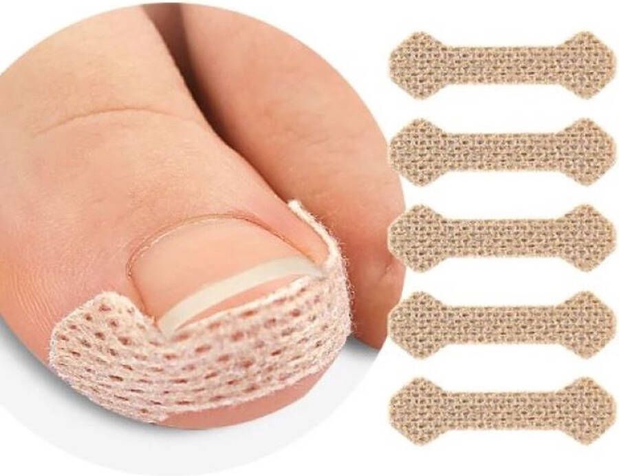 Ardran & Tookar Ingegroeide teennagel corrector 40 stickers
