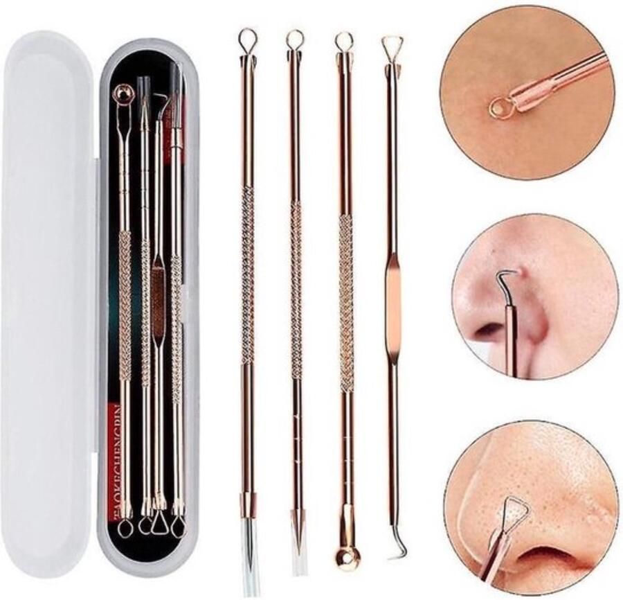 Astilla Products Mee-eters Verwijderen Blackhead Remover Puistjes Professionele Kit Acne Set 4 Luxe Puisten Lepels Mee Eter Lepel Rose