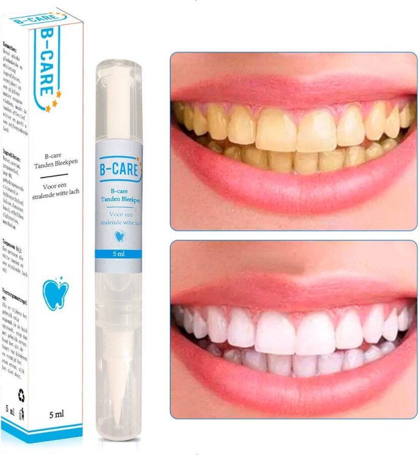 B-care Tanden Bleekpen Teeth Whitening Pen Tanden Bleker Wittere Tanden Teeth Whitening Strips Professioneel Resultaat Tandsteen Verwijderaar Zonder Peroxide Tandenbleekset Tanden Bleken Moederdag Cadeau