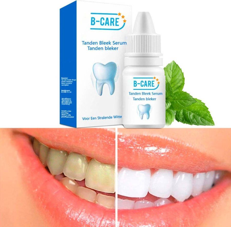 B-care Tanden Bleker – Wittere Tanden – Teeth Whitening Strips – Professioneel Resultaat Tandsteen Verwijderaar Zonder Peroxide Tandenbleekset Tanden Bleken Black Friday – Sinterklaas – Schoencadeautjes Sinterklaas