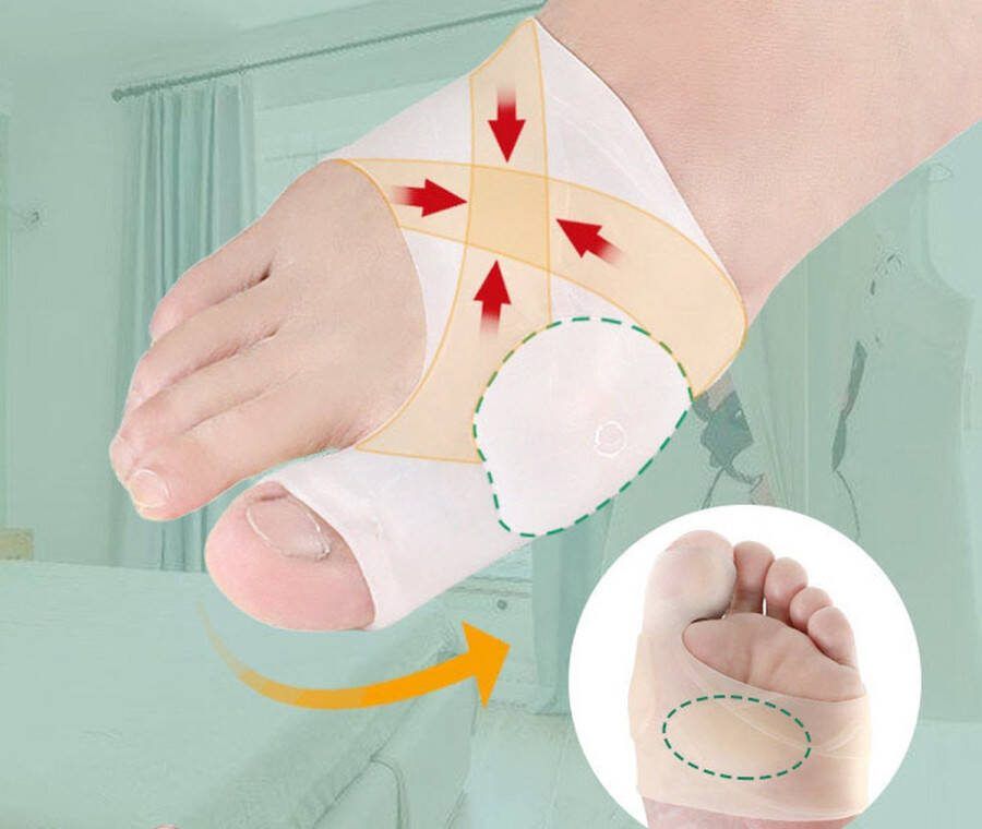 Cheaperito Hallux Valgus Siliconen Teenbeschermers I Teenspreiders I Teen Corrector I Knobbel I Bunion I Eeltknobbel Teen Rechtzetten I 1 Paar I Wit