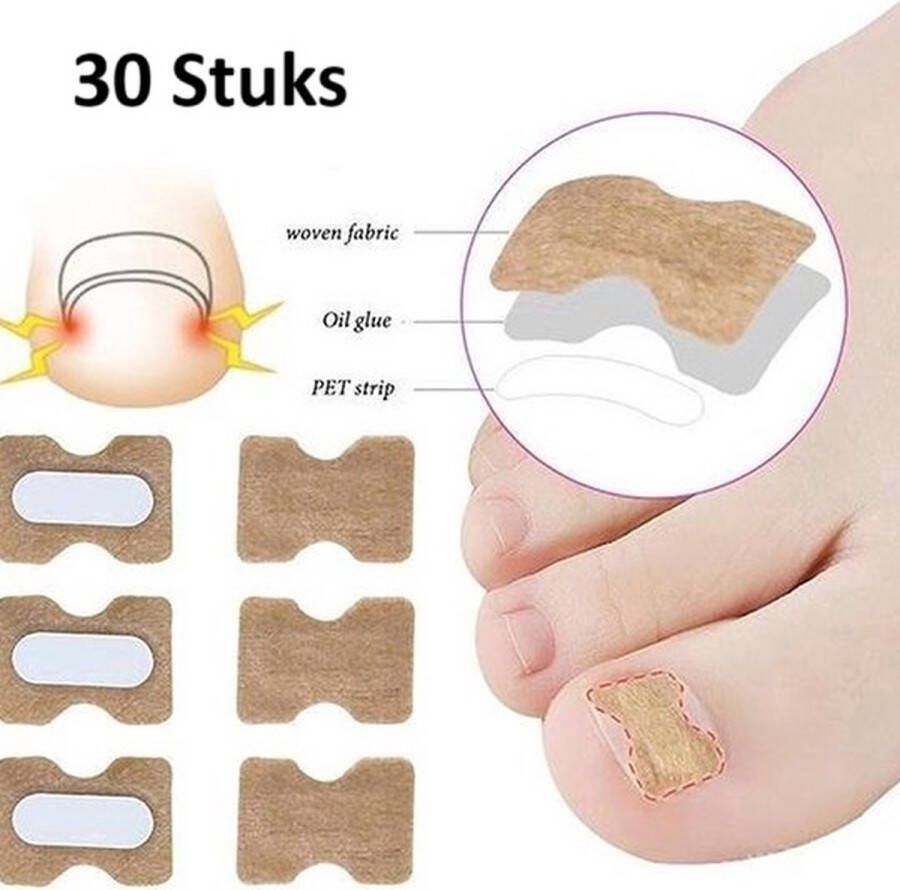 Cheaperito Set Van 30 Teennagel Lifters I Corrigeert Ingegroeide Teennagels I Teennagel Pleister I Anti Ingroei Pleister I Nagel Correctie Kit