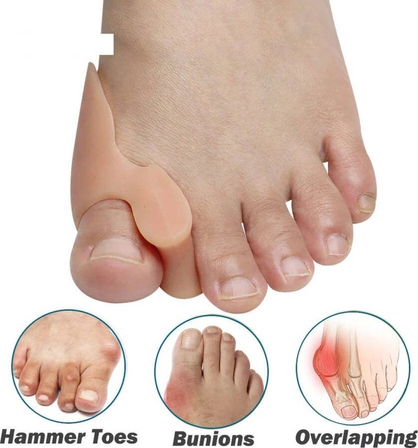 Cheaperito Siliconen Teencorrector I Teenspreider I Hallux Valgus I Grote Teen Beschermer I 1 Paar I Beige