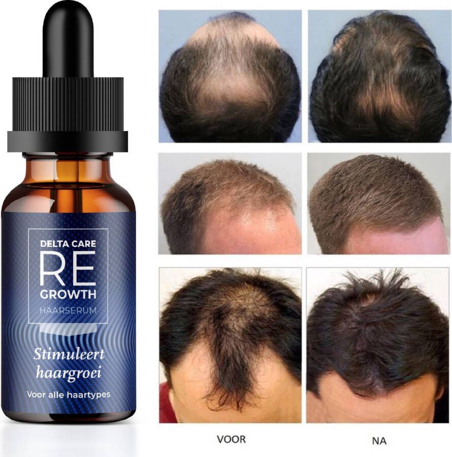 Delta Care Regrowth Haarserum Haargroei serum Haargroei versneller huidige haargroei verbeteren zonder Minoxidil 5% Haargroei Producten