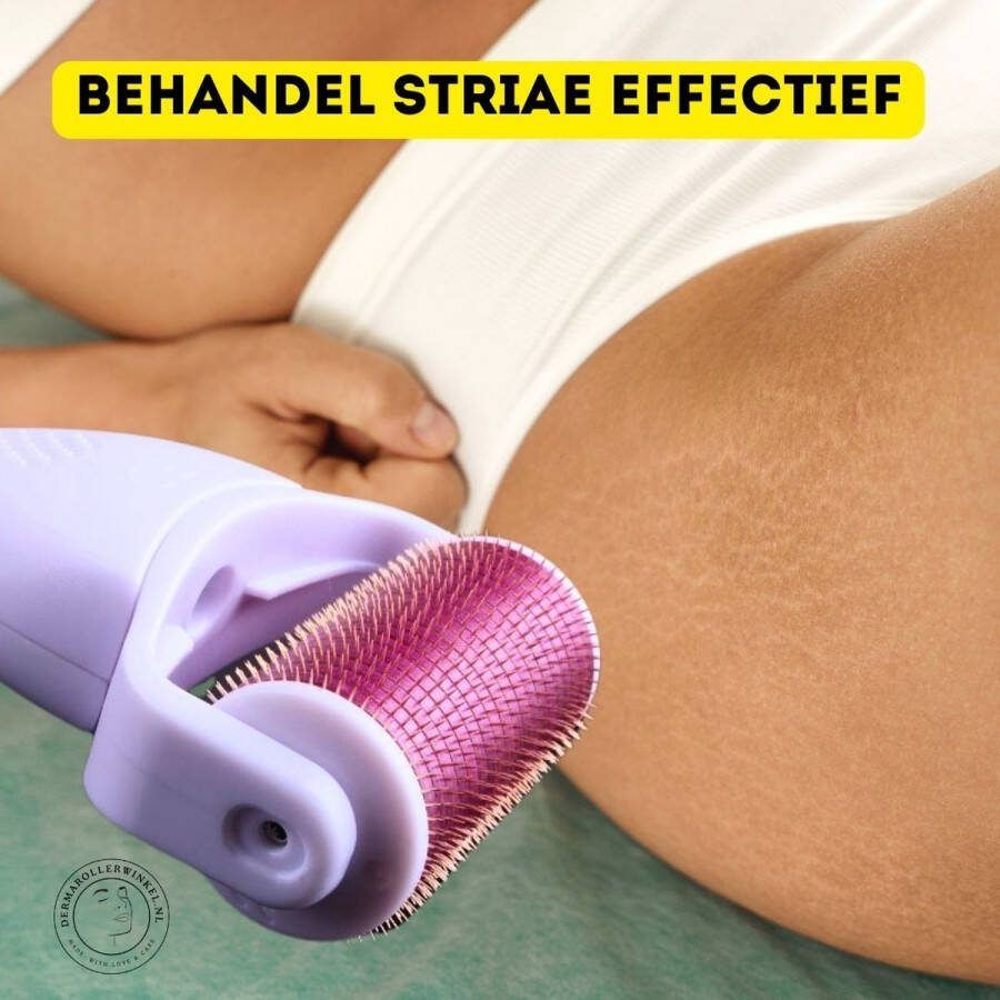 DRS Lichaams Roller Dermaroller Body GRATIS Retinol Serum 30 ml Stapelkorting!! Body Roller Naaldjes 2.0 mm 1200 Naaldjes Helpt Tegen Striae en Littekens Maakt Collageen en Elastine in de Huid Aan Vandaag Besteld Morgen in Huis!!