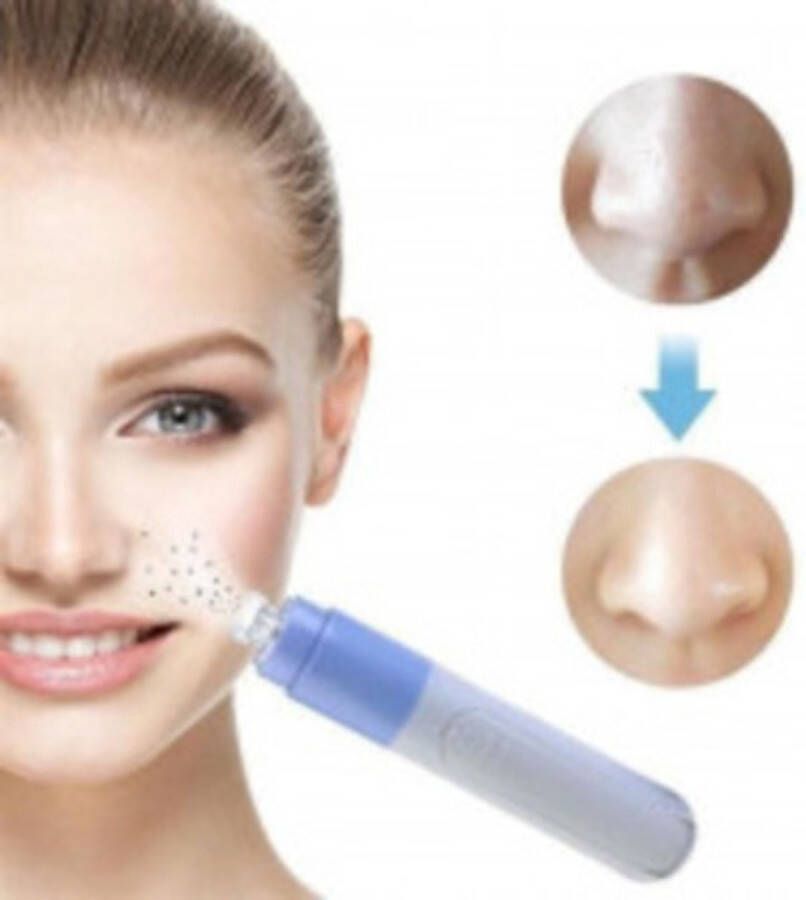 Blackhead remover mee eter verwijderaar porienreinger puistenverwijderaar schoonmaken huid gezichtreiniging gezichtsverzorging acne comedonen verwijderen