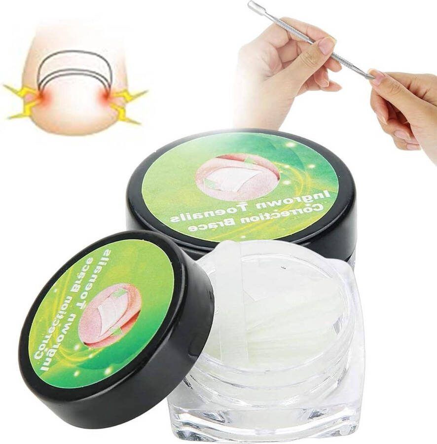 Nagelcorrectie Stickers Teennagelverzorging Pedicure Ingegroeide Teennagels Sets & Kits Teennagel Tool 24 Stks nagelbeugel