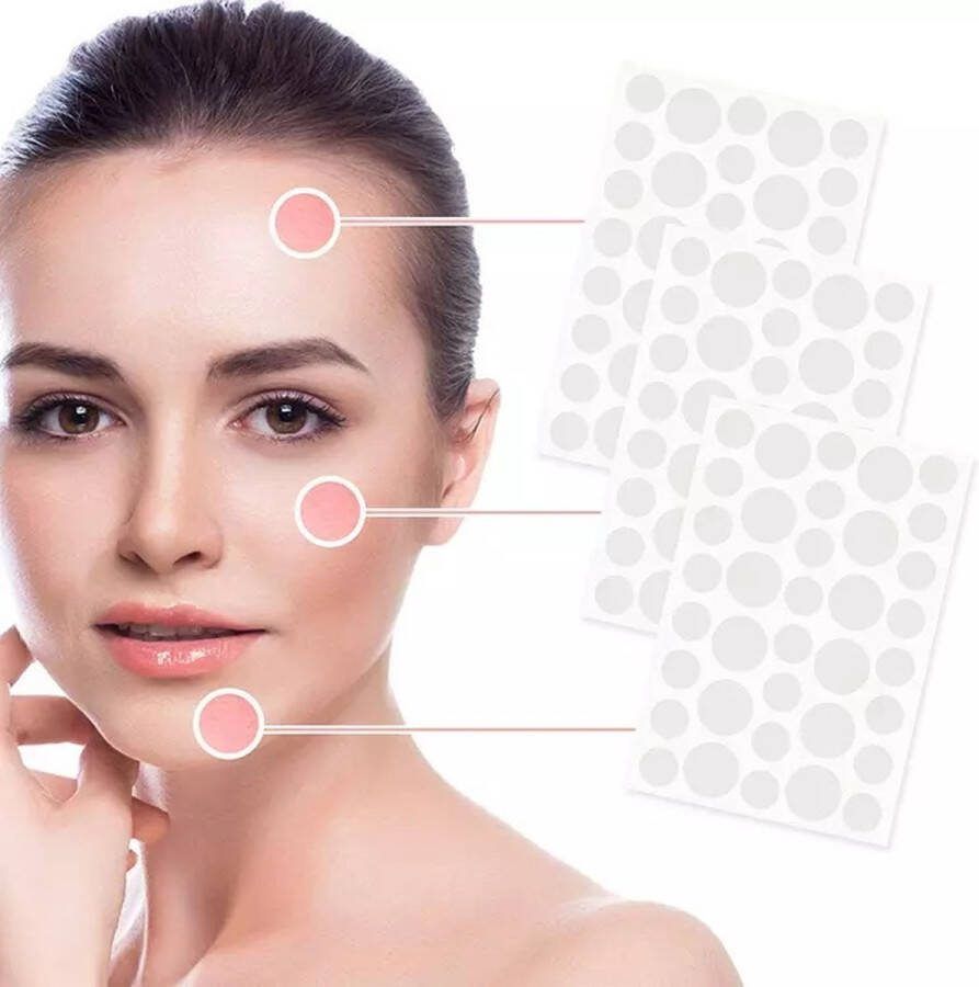 Pimple patches Acne patches Pimple patch puisten pleisters acne pleister 108 stuks