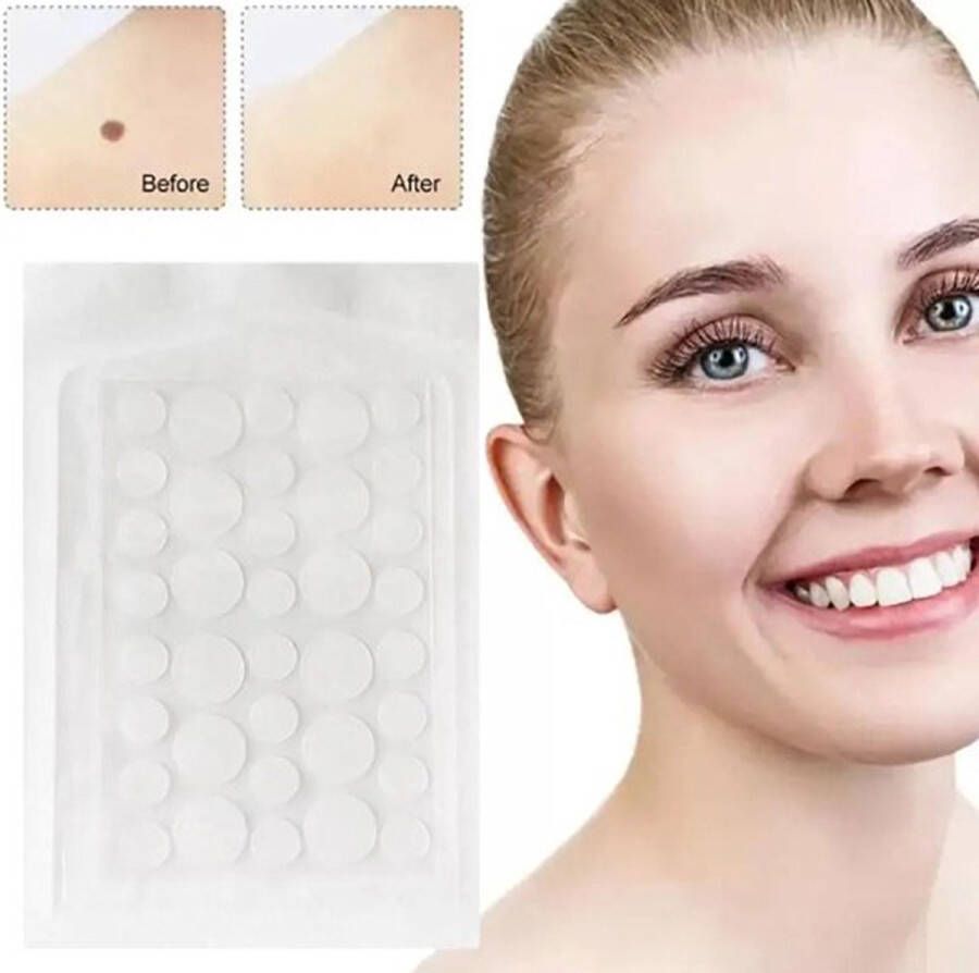 Puisten Verwijderraar Puisten Pleister Acne Pleister Acne Sticker Pimple Patch Acne Patch Puistjes Verwijderen 108 stuks