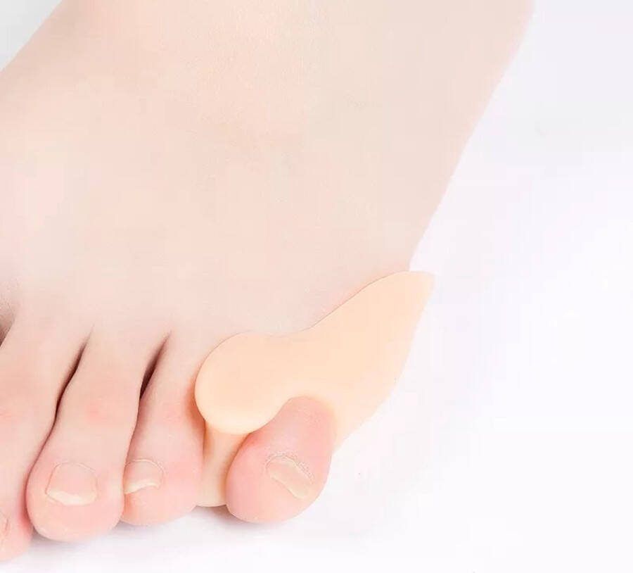 Teenspreider kleine teen Teenspreider Teencorrector likdoorn verwijderaar Teenspreiders voor hallux valgus hallux valgus Teenspalk Teenspreider siliconen Teenbeschermer Tenenspreider kleine teen 2 stuks