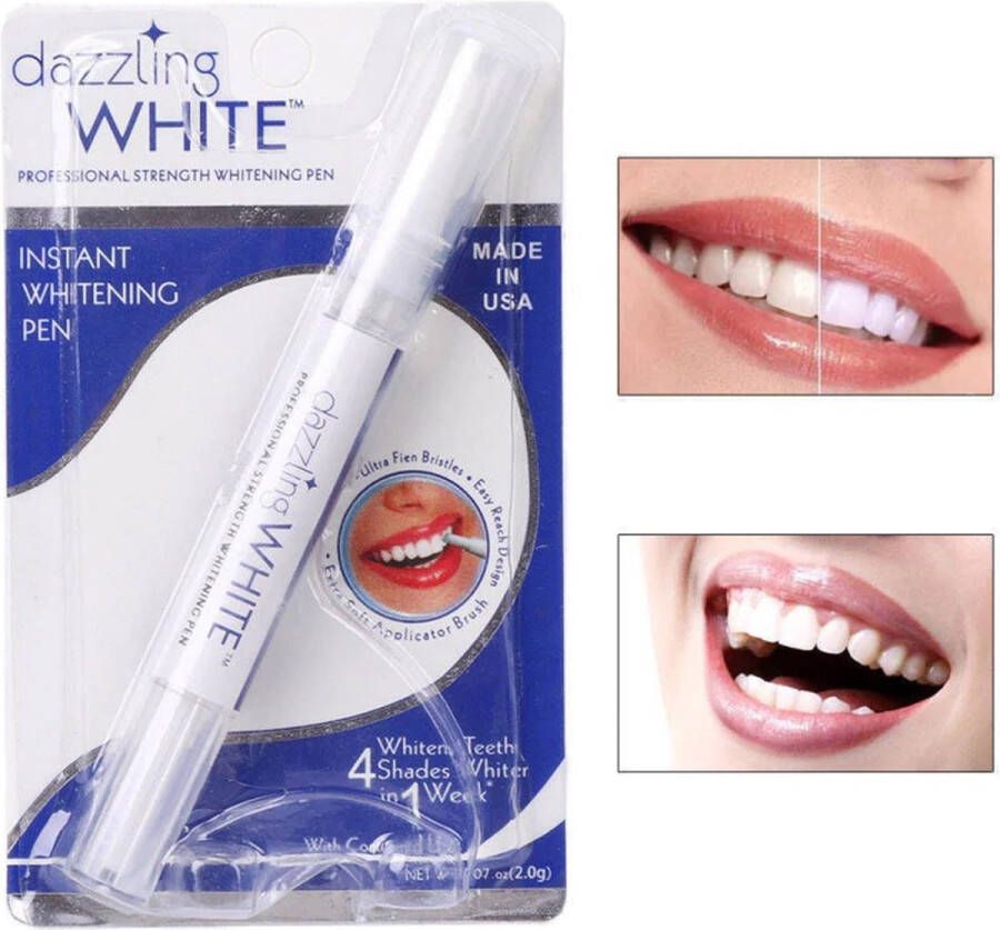EPIN B.V. | Teeth Whitening Pen | Tanden Bleken | Gemakkelijk en Snel