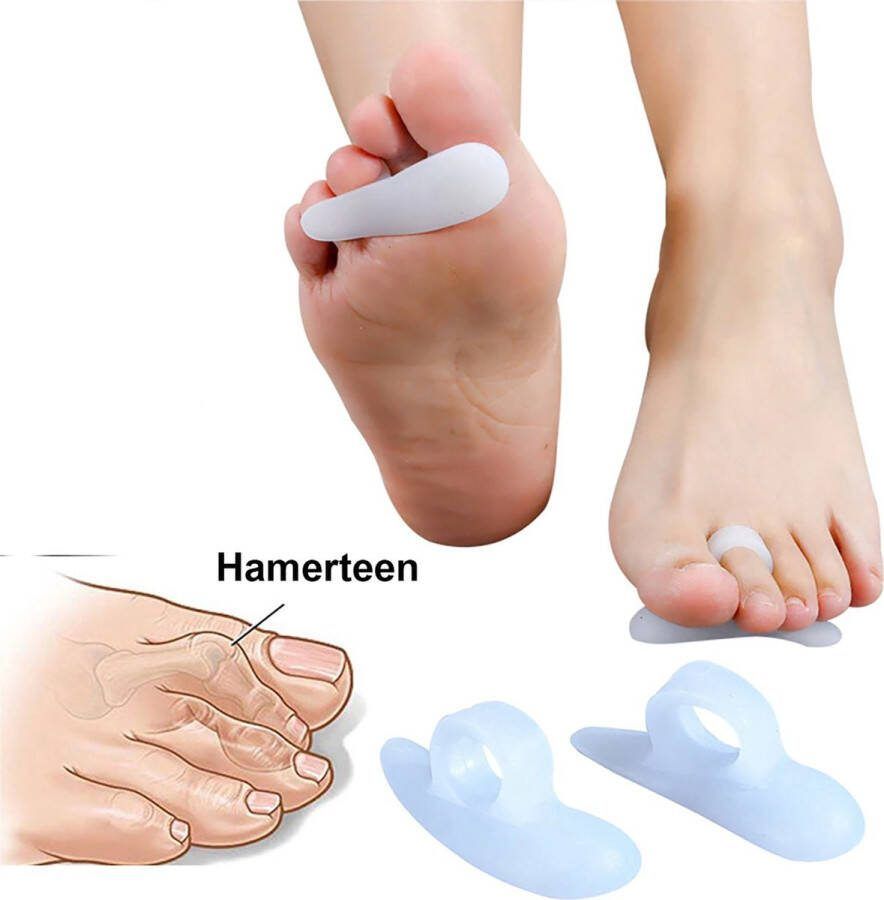 Finnacle Teenspreider Teencorrector Hamerteen Siliconen Teenbeschermer Pijnlijke voeten Voet accessoire Voetbescherming Hallux Valgus 2 stuks