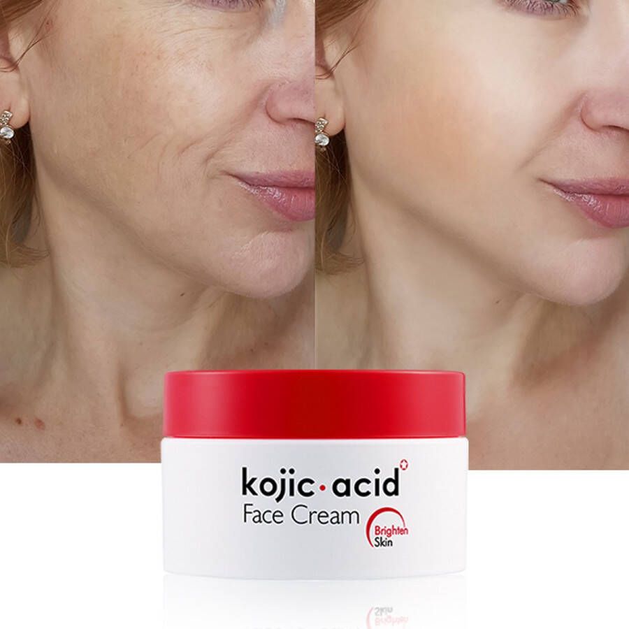 Guanjing Kojic Acid Gezichtscreme Kojic Acid Creme Antirimpel Anti-Rimpel Acne