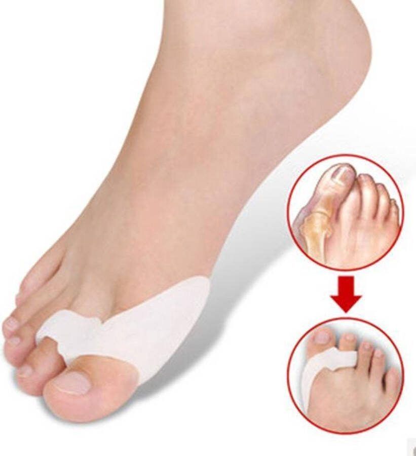 Heble *** Teenspreider Siliconen 2 Stuks Hallux Valgus Gel teenspreider van ***