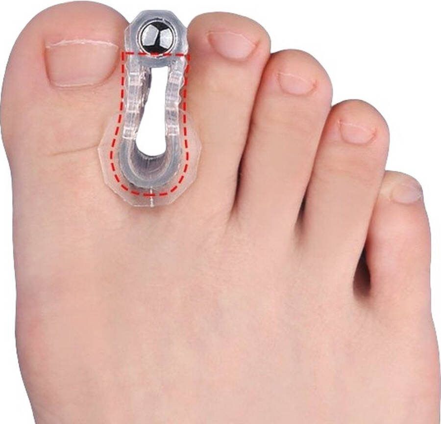 Hiden Teenspreider Siliconen Teen corrector Teenspreider voor alle tenen Hamer teen