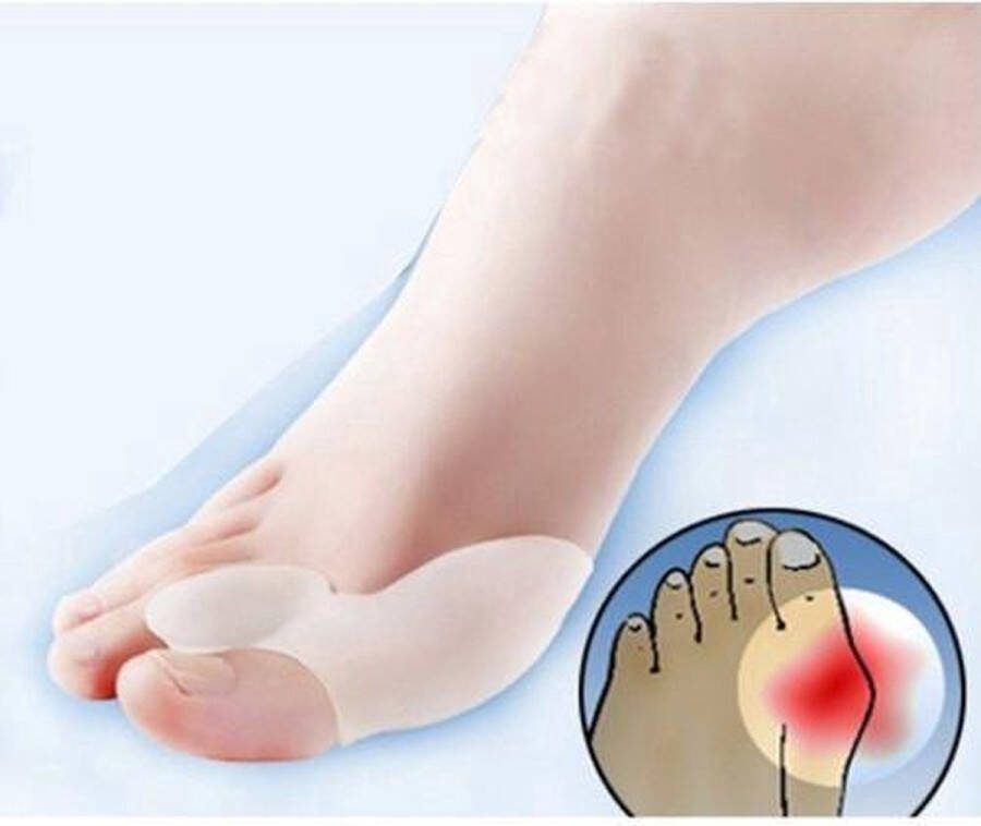Jumada 's Teenspreider Teen Spreiders- 4 stuks Pijnbestrijding- (Hallux Valgus)