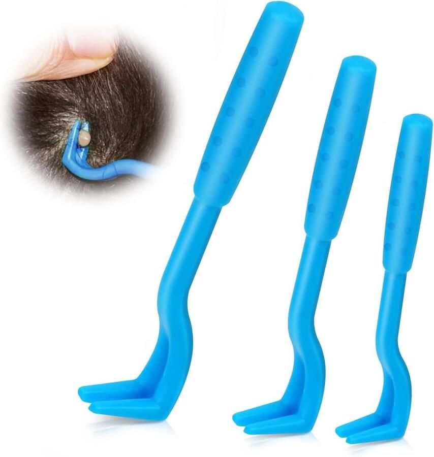 Lexium Tekentang Tekenpincet Tekenverwijderaar Tekenpincet mens Teek pincet Tekenlasso Tekenhaak Tekentang voor honden en katten
