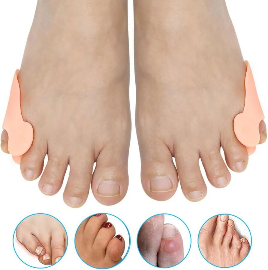 LOUZIR 2 Stuks Teenspreider kleine teen Teencorrector Teenbeschermer Teenspreiders voor hallux valgus Teenspalk