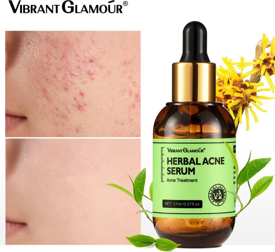 Vibrant Glamour Herbal Acne Serum Acne Puistjes SerumAcne face serum Anti acne Collageen Gezichtsverzorging Gezicht Serum