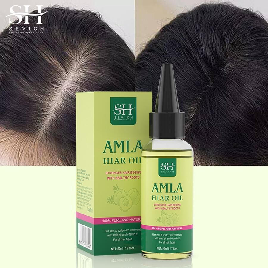 Xclusive Beauty Brands Amla Haarolie Amla Oil 100% Puur