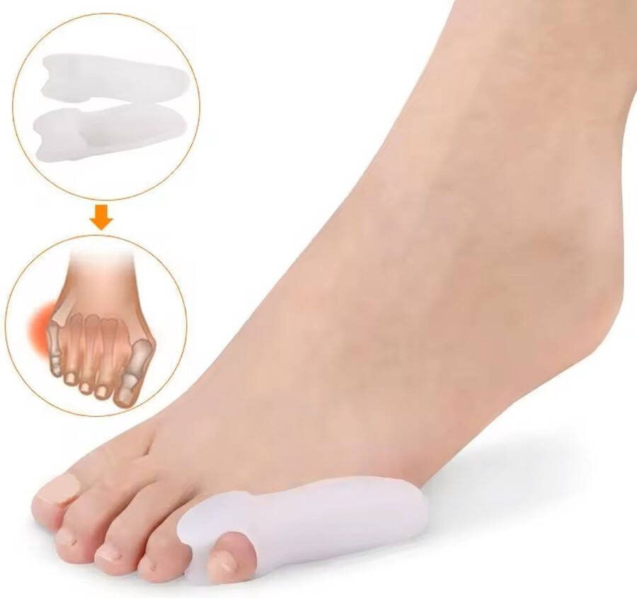 Xenovia Teenspreider kleine teen 1 Paar Wit teenspreider Teencorrector likdoorn verwijderaar Teenspreiders voor hallux valgus Teenspalk Teenspreider siliconen Teenbeschermer Tenenspreider kleine teen tenenspreider voor alle tenen