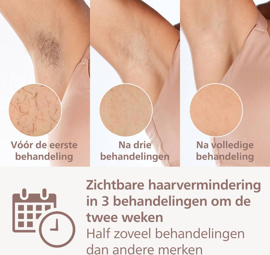 Philips Lumea Prestige BRI947 00 IPL Ontharingsapparaat Voor Lichaam en Gezicht - Foto 4